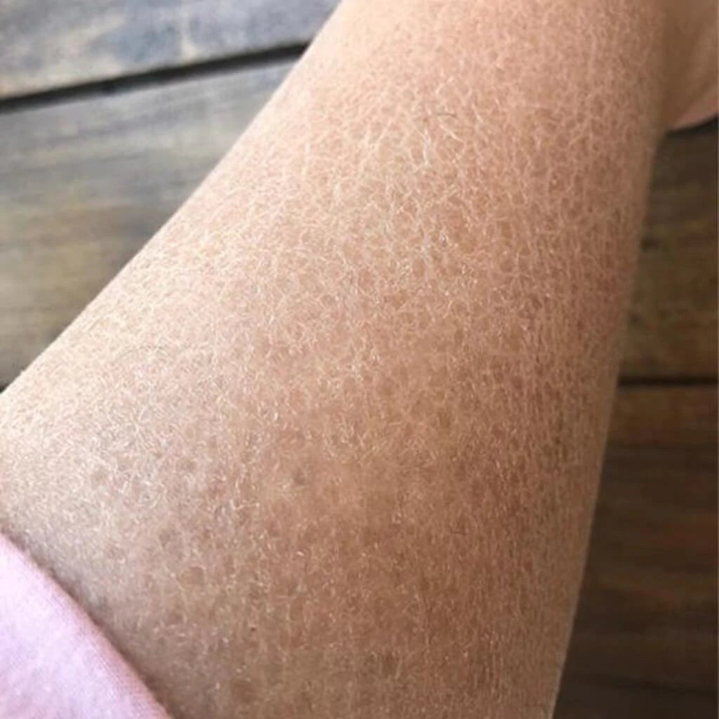 Balaayah Black Gram Booster Pack of 2